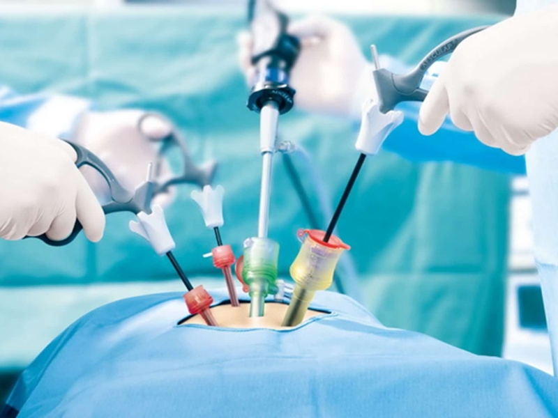 best laparoscopic surgeon in delhi
