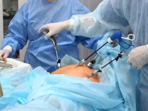 Laparoscopic Surgery in Delhi: What Patients Should Know Before Treatment at PSRI Hospital
