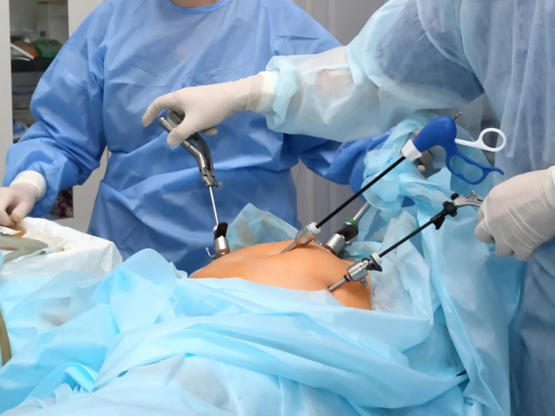 best laparoscopic surgeon in delhi
