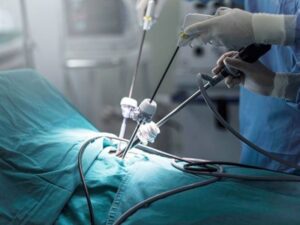 Robotic Surgery in Delhi: Simple Treatment Guide