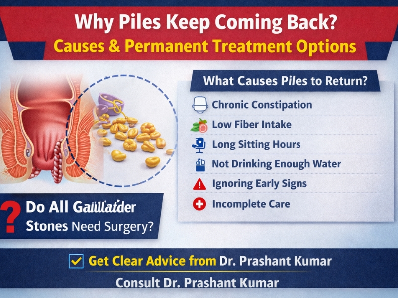 Why piles keep coming back causes and prevention explained by specialist in New Delhi