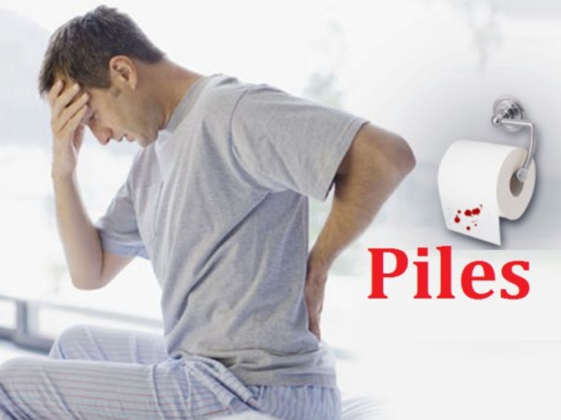Piles symptoms and treatment options in New Delhi explained by surgeon