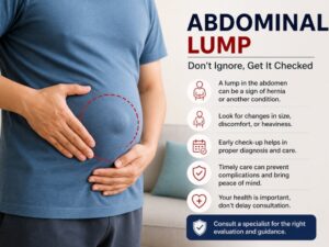 Lump in Abdomen: How to Know If It Is Hernia in Delhi | PSRI Hospital