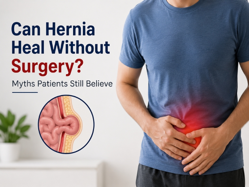 Illustration explaining whether hernia can heal without surgery and common hernia treatment myths