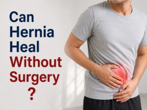 Can Hernia Heal Without Surgery? Myths Patients Still Believe at PSRI Hospital New Delhi