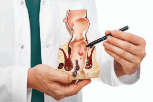 Specialist explaining piles treatment in Delhi to patient