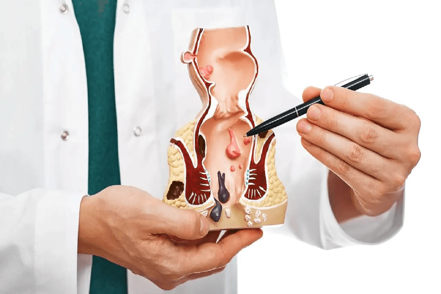 Specialist explaining piles treatment in Delhi to patient