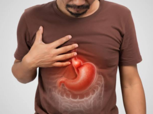 Hiatal Hernia Symptoms, Causes and Treatment Options in Delhi | Dr. Prashant Kumar