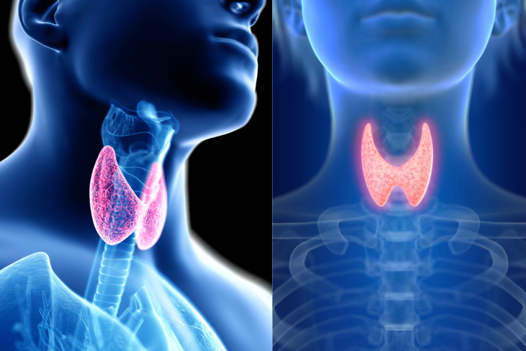 Thyroid Surgery